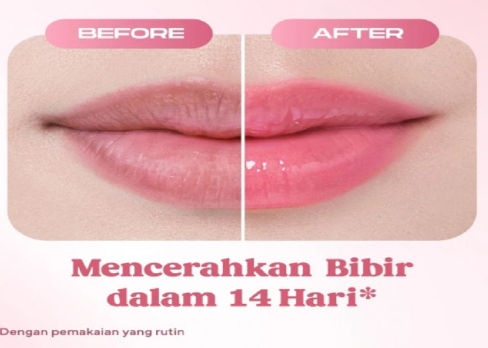 Rekomendasi Lip Balm untuk Bibir Hitam yang Ramah Kantong, Solusi Hemat Dapatkan Bibir Sehat Merona