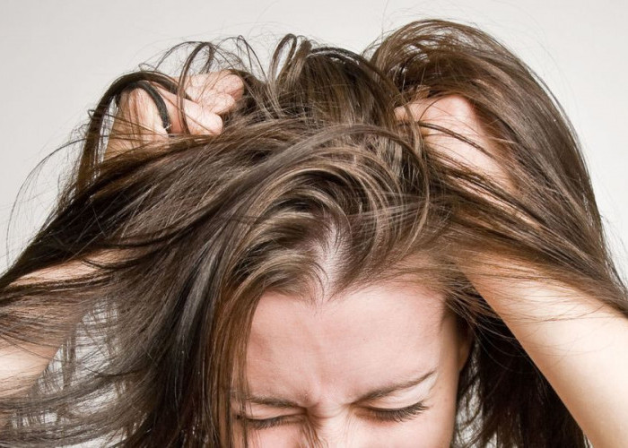 7 Cara Mengatasi Rambut Lepek dan Bau Hanya dalam 10 Menit!