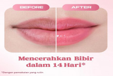 Rekomendasi Lip Balm untuk Bibir Hitam yang Ramah Kantong, Solusi Hemat Dapatkan Bibir Sehat Merona