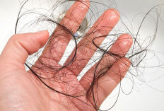 Cara Mengatasi Rambut Rontok Parah Menggunakan Bahan Alami di Rumah