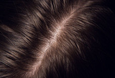 4 Tips Merawat Kulit Kepala Agar Tetap Sehat: Ketombe Hilang dalam 1 Minggu