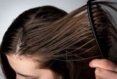 Penyebab Rambut Cepat Berminyak Serta Cara Mengatasi Rambut Lepek dan Bau secara Alami